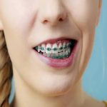 موم ار تودنسی کره ای Amiden